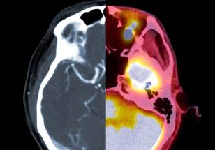 ReachMD Healthcare Image