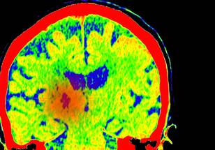 ReachMD Healthcare Image